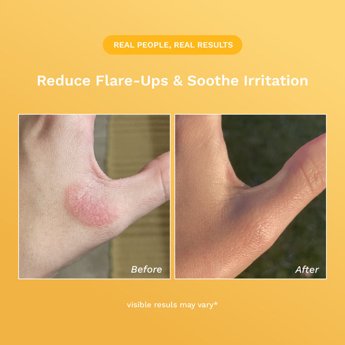 Rejûvaskin Skin Recovery Cream product image 6