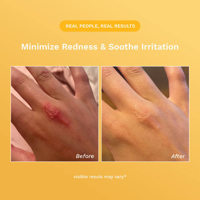 Rejûvaskin Skin Recovery Cream product image 7